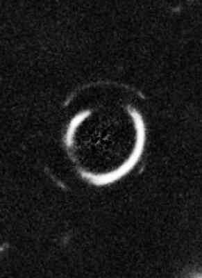 Gravitational lenses: Einstein's double ring - NASA.